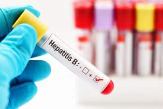 hepatit B