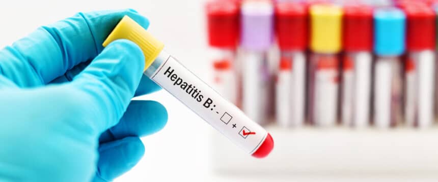 hepatit B